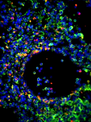 Lung tissue from cIAP2-deficient mice showing effects on epithelial cells of influenza infection Image credit: Claudia Champagne, McGill University