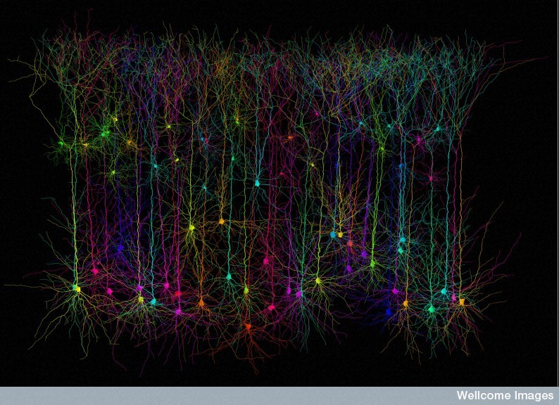 Image: Prof. M. Hausser / UCL / Wellcome Images/flickr