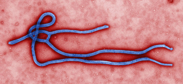 Ebola_virus_virion