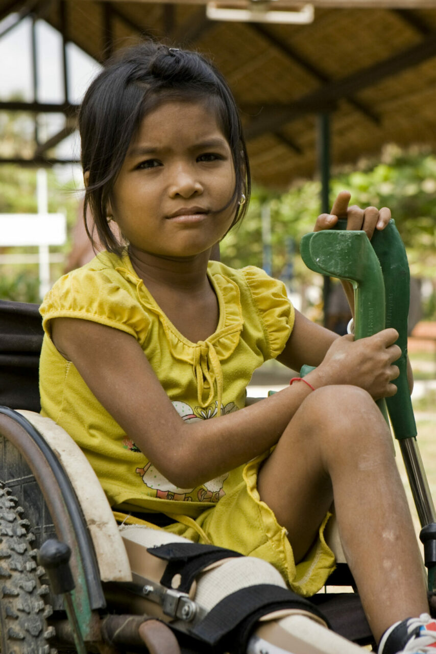 Polio girl (Image: RIBI Image Library/flickr)