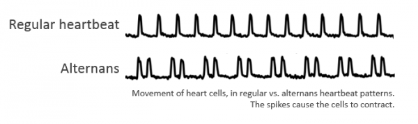 alternans_en_0