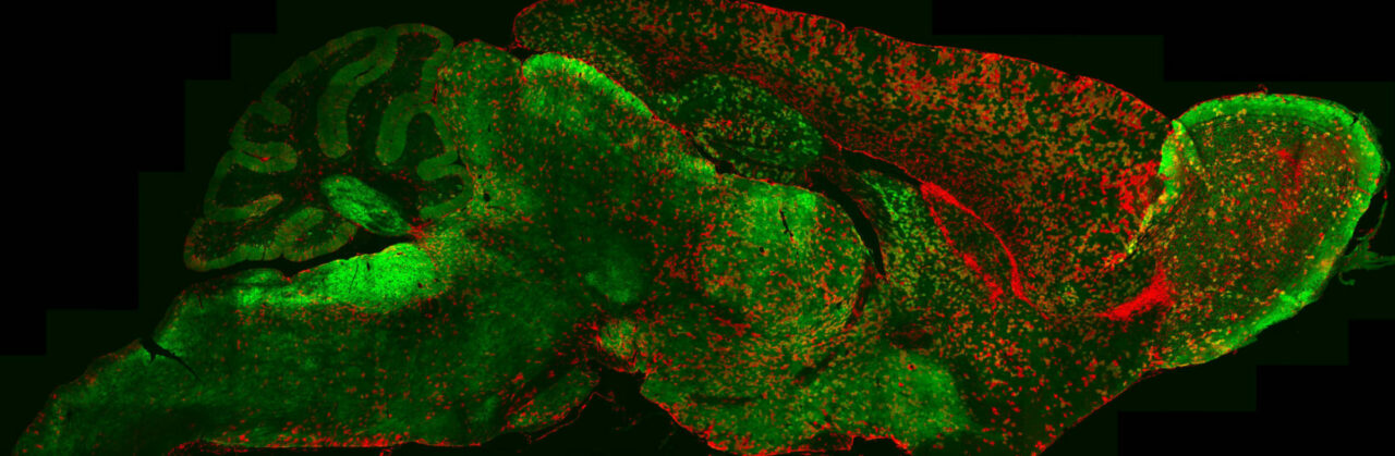 4-astrocytes_whole_brain_313907