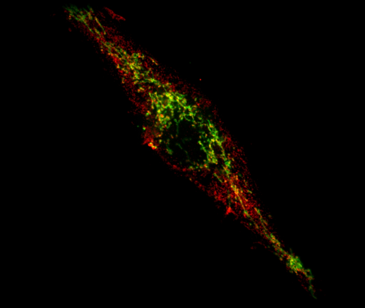 A cell where the Parkinson's disease-related protein PINK1 is absent is in the process of presenting mitochondrial antigens (in red) at its surface to alert the immune system. Intact mitochondria are observed as rod-like structures in green.