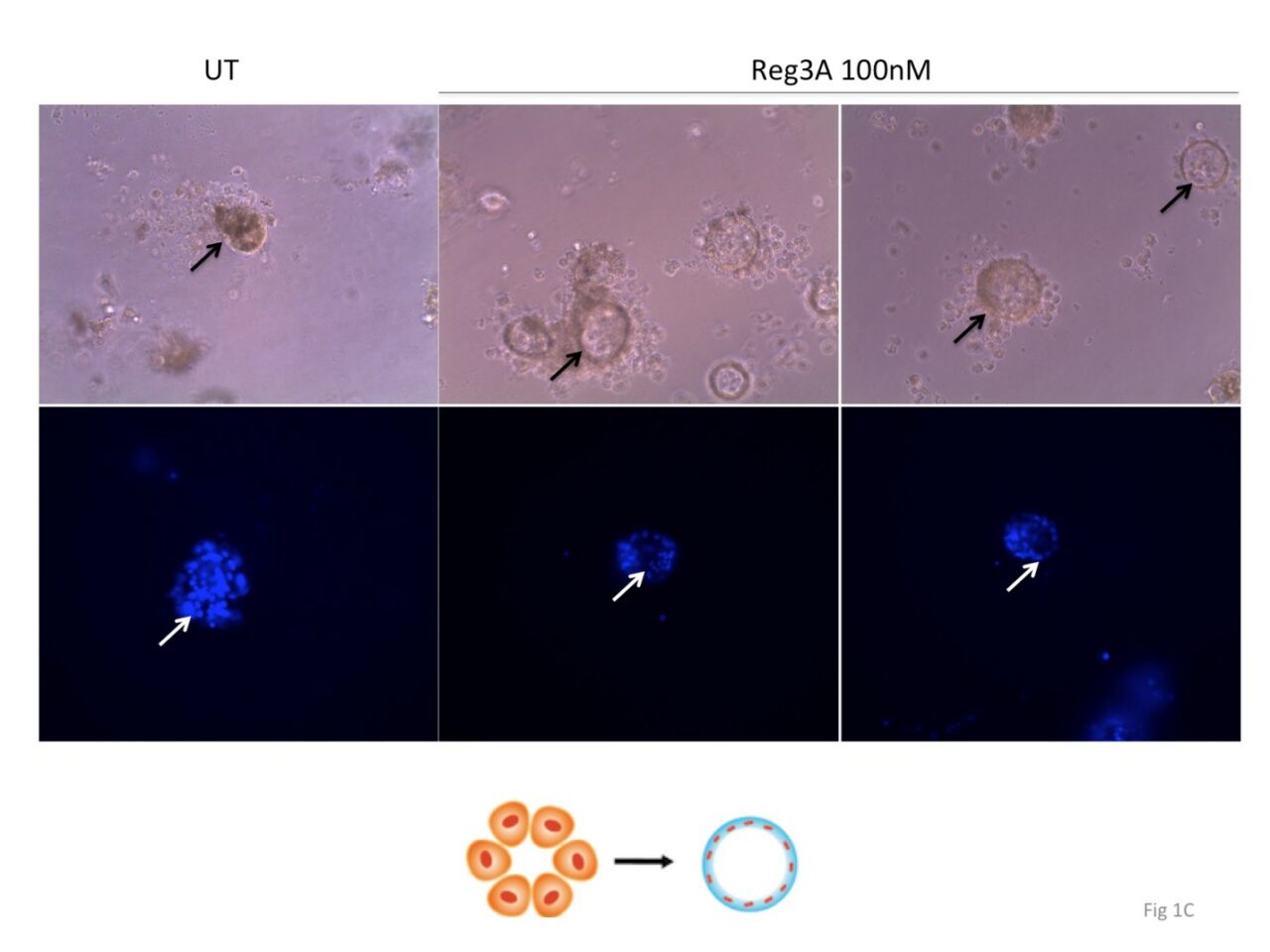 This first 3-D culture picture conducted by graduate student Qing Li shows Reg 3A promote acinar-ductal transformation and pancreatic cancer carcinogenesis .